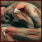 Sciatica Pain
